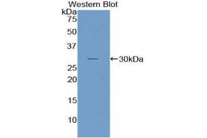 Western blot analysis of the recombinant protein. (NUP107 antibody  (AA 554-784))