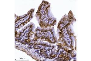 IHC analysis of JHDM3A/JMJD2A/KDM4A using anti-JHDM3A/JMJD2A/KDM4A antibody (ABIN7601534). (KDM4A antibody  (AA 379-1064))