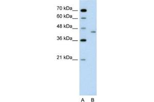 Western Blotting (WB) image for anti-LRP2 Binding Protein (LRP2BP) antibody (ABIN2462598) (LRP2BP antibody)