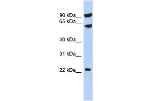 TIGD3 antibody used at 1 ug/ml to detect target protein.