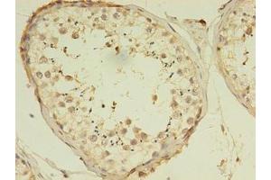 Immunohistochemistry of paraffin-embedded human testis tissue using ABIN7175077 at dilution of 1:100 (C1ORF53 antibody  (AA 46-116))