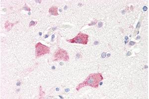 ABIN185519 (5µg/ml) staining of paraffin embedded Human Cortex. (RPS19 antibody  (Internal Region))