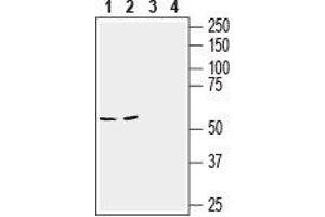 Western blot analysis of mouse brain (lanes 1 and 3) and colon (lanes 2 and 4) lysates: - 1,2. (Slc6a14 antibody  (2nd Extracellular Loop))