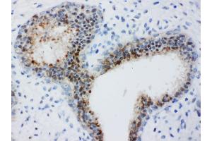 Immunohistochemistry (IHC) image for anti-Budding Uninhibited By Benzimidazoles 3 Homolog (Yeast) (BUB3) (AA 76-90), (Middle Region) antibody (ABIN3044239)