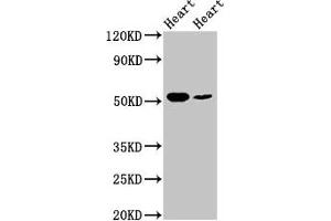 Western Blot Positive WB detected in: Rat heart tissue, Mouse heart tissue All lanes: ILK antibody at 5 μg/mL Secondary Goat polyclonal to rabbit IgG at 1/50000 dilution Predicted band size: 52, 45, 37 kDa Observed band size: 52 kDa (ILK antibody  (AA 1-228))