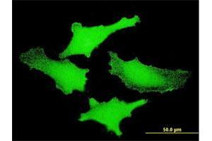 Immunofluorescence of monoclonal antibody to PIM1 on HeLa cell. (PIM1 antibody  (AA 1-313))