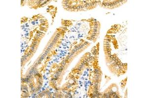 Immunohistochemistry (Paraffin-embedded Sections) (IHC (p)) image for anti-Annexin A4 (ANXA4) antibody (ABIN7073066)