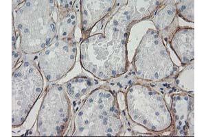 Immunohistochemical staining of paraffin-embedded Human Kidney tissue using anti-LDLRAP1 mouse monoclonal antibody. (LDLRAP1 antibody)