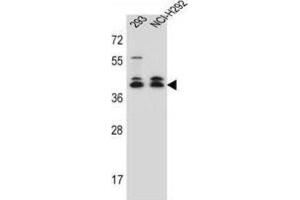 Western Blotting (WB) image for anti-DMRT-Like Family C2 (DMRTC2) antibody (ABIN2997143)