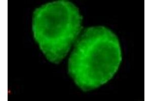 Immunocytochemistry of HeLa cells using anti-JMJD6(N-terminus) mouse mAb diluted 1:200. (JMJD6 antibody  (N-Term))