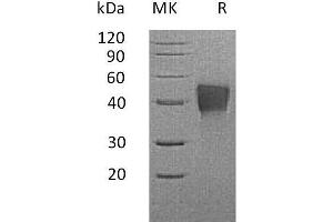 Tumor-Associated Calcium Signal Transducer 2 (TACSTD2) protein (His tag)