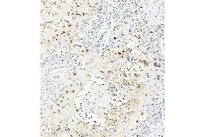 IHC analysis of MAFA using anti-MAFA antibody (ABIN7602623). (MAFA antibody  (AA 9-308))