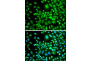 Immunofluorescence analysis of MCF-7 cells using SETD5 antibody (ABIN5974406). (SETD5 antibody)