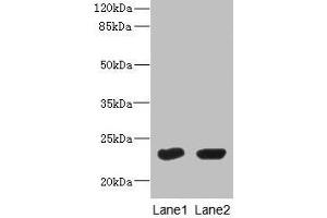 Western Blot All lanes: UBE2T antibody at 10 μg/mL Lane 1: HepG2 whole cell lysate Lane 2: Hela whole cell lysate Secondary Goat polyclonal to rabbit IgG at 1/10000 dilution Predicted band size: 23 kDa Observed band size: 23 kDa (Ube2t antibody  (AA 1-197))