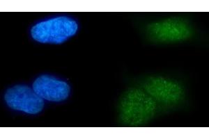 IF analysis of MSL2 using anti-MSL2 antibody (ABIN7599488). (MSL2 antibody  (AA 1-577))