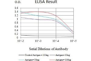 Black line: Control Antigen (100 ng),Purple line: Antigen (10 ng), Blue line: Antigen (50 ng), Red line:Antigen (100 ng) (CYLD antibody  (AA 204-358))