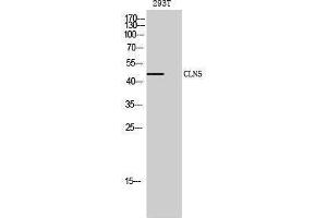 Western Blotting (WB) image for anti-Ceroid-Lipofuscinosis, Neuronal 5 (CLN5) (Internal Region) antibody (ABIN3174448) (CLN5 antibody  (Internal Region))
