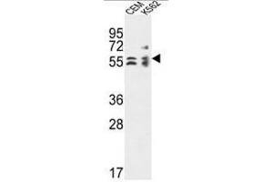 TBCE Antibody (Center) western blot analysis in CEM,K562 cell line lysates (35µg/lane). (TBCE antibody  (Middle Region))