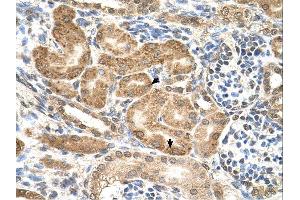 GMPPB antibody was used for immunohistochemistry at a concentration of 4-8 ug/ml. (GMPPB antibody  (C-Term))