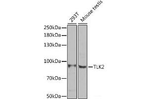Western blot analysis of extracts of various cell lines using TLK2 Polyclonal Antibody at dilution of 1:1000. (TLK2 antibody)
