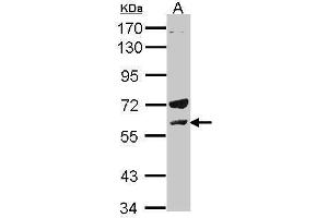 WB Image Sample(30 μg of whole cell lysate) A:H1299 7. (LCK antibody  (C-Term))