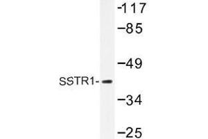 Image no. 1 for anti-Somatostatin Receptor 1 (SSTR1) antibody (ABIN317866) (SSTR1 antibody)