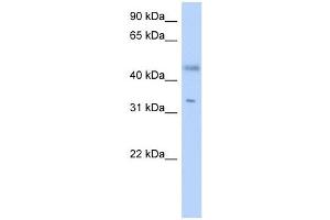 RDHE2 antibody used at 1 ug/ml to detect target protein.