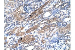 KIAA0319 antibody was used for immunohistochemistry at a concentration of 4-8 ug/ml to stain Epithelial cells of renal tubule (arrows) in Human Kidney. (KIAA0319 antibody  (N-Term))