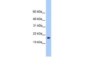 WB Suggested Anti-C6orf173 Antibody Titration: 0. (CENPW antibody  (N-Term))