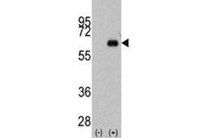 Western blot analysis of anti-Myc antibody and 293 cell lysate (2 ug/lane) either nontransfected (Lane 1) or transiently transfected with the MYC gene (2). (c-MYC antibody  (AA 40-69))