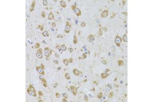 Immunohistochemistry (Paraffin-embedded Sections) (IHC (p)) image for anti-Eukaryotic Translation Elongation Factor 1 beta 2 (EEF1B2) (AA 1-225) antibody (ABIN6139949)
