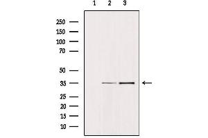 Western blot analysis of extracts from various samples, using TACSTD1  Antibody.