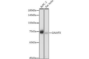 Western blot analysis of extracts of various cell lines, using G antibody (ABIN6131444, ABIN6140942, ABIN6140944 and ABIN6218180) at 1:1000 dilution.
