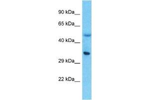 Host:  Rabbit  Target Name:  LPPR5  Sample Type:  Thymus Tumor lysates  Antibody Dilution:  1. (LPPR5 antibody  (N-Term))