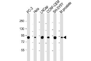 All lanes : Anti-TGM4 Antibody (Center) at 1:1000-1:2000 dilution Lane 1: PC-3 whole cell lysateLane 2: Hela whole cell lysate Lane 3: LNCap whole cell lysate Lane 4: CCRF-CEM whole cell lysate Lane 5: SH-SY5Y whole cell lysate Lane 6: Mouse prostate whole tissue lysate Lysates/proteins at 20 μg per lane. (TGM4 antibody  (AA 135-164))
