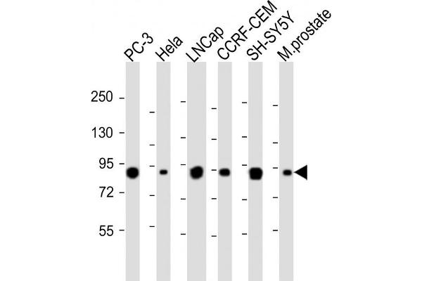 TGM4 antibody  (AA 135-164)