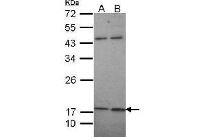 WB Image Sample (30 ug of whole cell lysate) A: A431 , B: H1299 12% SDS PAGE antibody diluted at 1:1000 (KCNMB1 antibody  (Center))