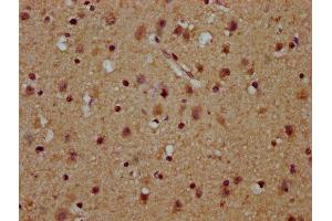 IHC image of ABIN7174180 diluted at 1:100 and staining in paraffin-embedded human brain tissue performed on a Leica BondTM system. (C16orf57 antibody  (AA 1-90))