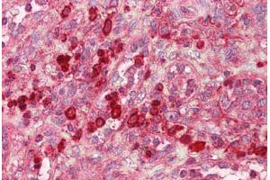 Anti-GZMB / Granzyme B antibody IHC staining of human spleen. (GZMB antibody  (AA 10-59))