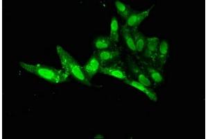 Immunofluorescent analysis of Hela cells using ABIN7153034 at dilution of 1:100 and Alexa Fluor 488-congugated AffiniPure Goat Anti-Rabbit IgG(H+L) (FOXE1 antibody  (AA 184-365))