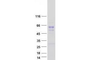 Validation with Western Blot (CPQ Protein (Myc-DYKDDDDK Tag))