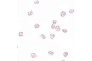 Immunohistochemistry (IHC) image for anti-SRY (Sex Determining Region Y)-Box 2 (SOX2) (N-Term) antibody (ABIN1031582) (SOX2 antibody  (N-Term))
