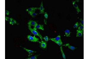 Immunofluorescent analysis of Hela cells using ABIN7168440 at dilution of 1:100 and Alexa Fluor 488-congugated AffiniPure Goat Anti-Rabbit IgG(H+L) (ROBO1 antibody  (AA 29-143))