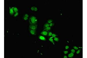 Immunofluorescent analysis of PC-3 cells using ABIN7155391 at dilution of 1:266 and Alexa Fluor 488-congugated AffiniPure Goat Anti-Rabbit IgG(H+L) (HIST1H2BB antibody  (AA 2-126))