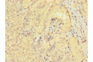 Immunohistochemistry of paraffin-embedded human adrenal gland tissue using ABIN7171870 at dilution of 1:100 (TSPAN32 antibody  (AA 111-202))