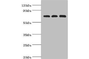 Western blot All lanes: Calcium-binding mitochondrial carrier protein Aralar2 antibody at 4 μg/mL Lane 1: Mouse liver tissue Lane 2: Mouse kidney tissue Lane 2: HepG2 whole cell lysate Secondary Goat polyclonal to rabbit IgG at 1/10000 dilution Predicted band size: 74 kDa Observed band size: 74 kDa (slc25a13 antibody  (AA 1-300))