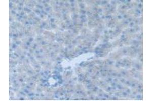 IHC-P analysis of Rat Liver Tissue, with DAB staining. (CEACAM1 antibody  (AA 36-145))
