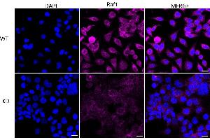 anti-V-Raf-1 Murine Leukemia Viral Oncogene Homolog 1 (RAF1) antibody