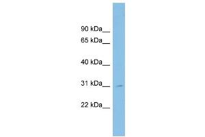 WB Suggested Anti-SPATA9 Antibody Titration: 0.