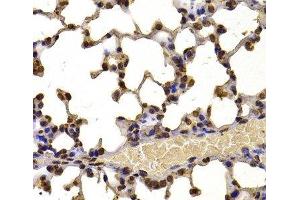 Immunohistochemistry of paraffin-embedded Mouse lung using WHSC1 Polyclonal Antibody at dilution of 1:100 (40x lens). (WHSC1 antibody)